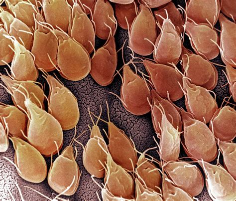 Giardia Lamblia Protozoan Photograph By Ami Imagesscience Photo Library Fine Art America