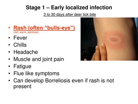 Ppt Lymes Disease Borreliosis Powerpoint Presentation Free Download Id9727246