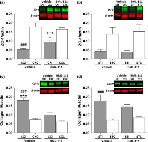 Neurovascular Protection By Postischemic Intravenous Injections Of The