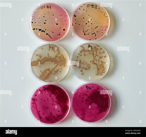 Growing Bacteria In A Petri Dish Stem Activity For Kids