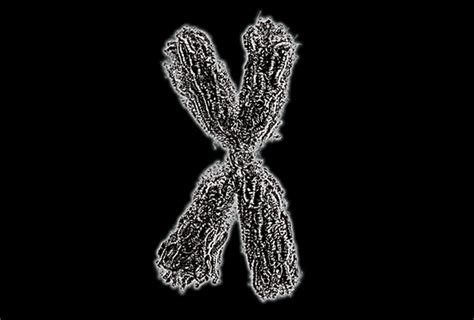 X chromosome variants help explain the sexual bias of autism – US Today ...