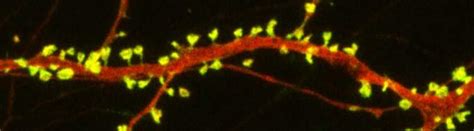 dendritic spines : Bipolar Network News