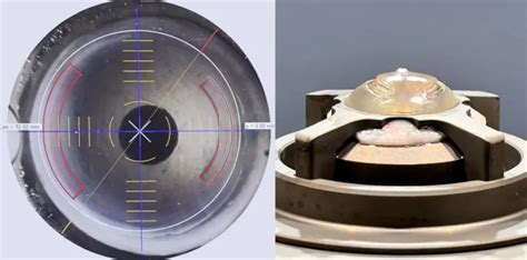 Femto Cairs For Keratoconus