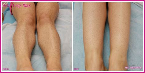 Bikini Wax Before And After Women