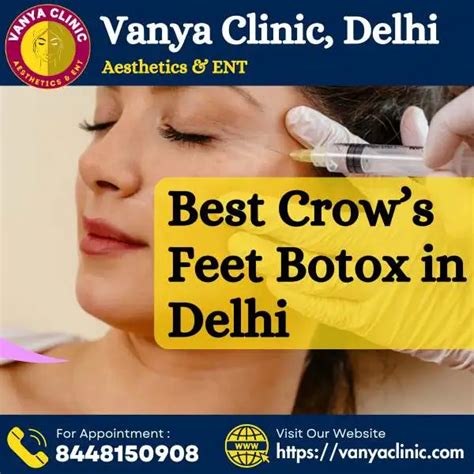 Crows Feet Botox Treatment In South Delhi Near Green Park