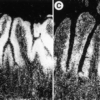 Bright Field A And Dark Field B Photomicrographs Of The Mucosa Of