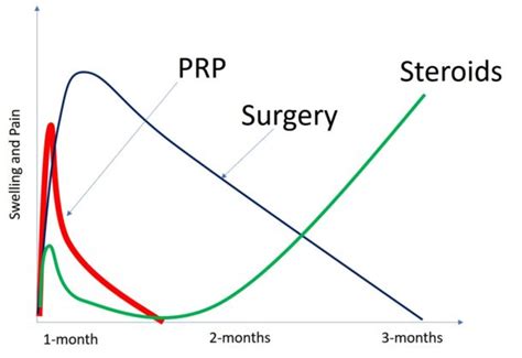 Whats The Average Recovery Time After A Prp Injection