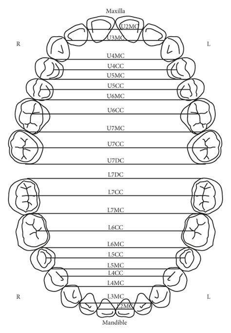 Illustration Of The Maxillary And Mandibular Arches Widths As