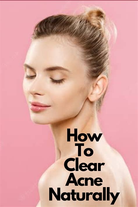 How To Clear Acne Naturally Fashonation