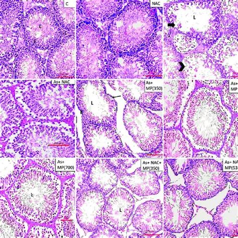 Representative Photographs Of H And E Stained Sections Of Testis