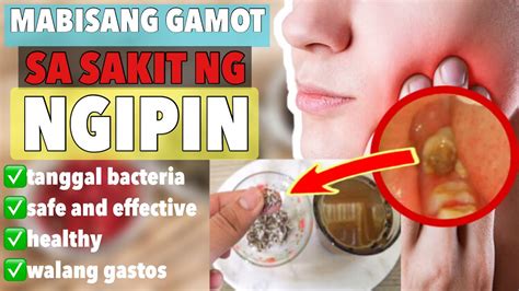 Pinakamura At Mabisang Gamot Sa Sakit Ng Ngipin Mura Na Healthy Pa