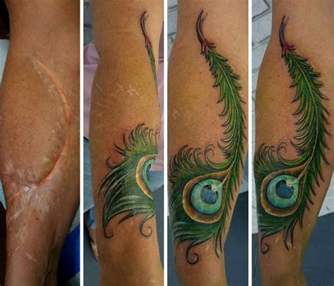 10 Amazing Tattoos That Turn Scars Into Works Of Art Bored Panda