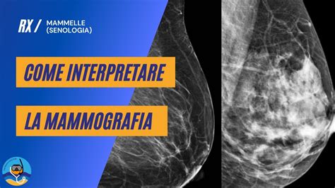 Come Interpretare La Mammografia Youtube