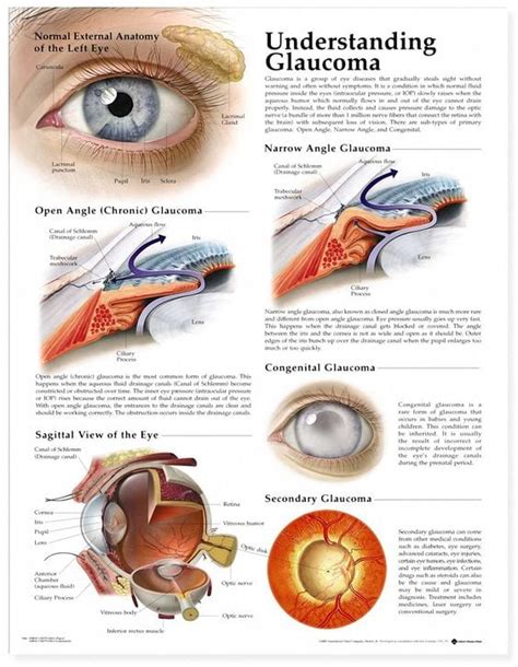 Glaucoma Treatment Options in Amherst, MA and Florence, MA