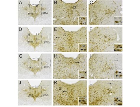 Representative Photomicrographs Of C Fos Immunostaining In Serotonergic