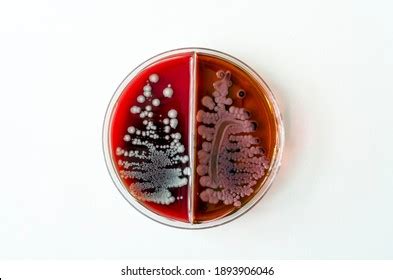 Characteristic Mucoid Colonies Klebsiella Pneumoniae On Stock Photo