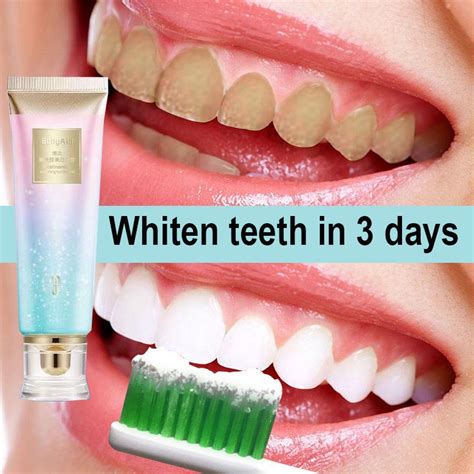 Whitening Toothpaste Ubat Gigi Pemutih Kuning Teeth Whitening