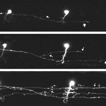 Time Lapse Analysis Of CiA Interneuron Development Two GFP Labeled