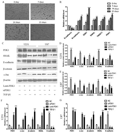 The PDK1 cJun pathway activated by TGFβ induces EMT and promotes