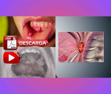 OdontoVida: Cirugía Bucal