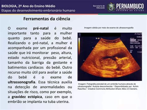 Etapas do desenvolvimento embrionário humano ppt