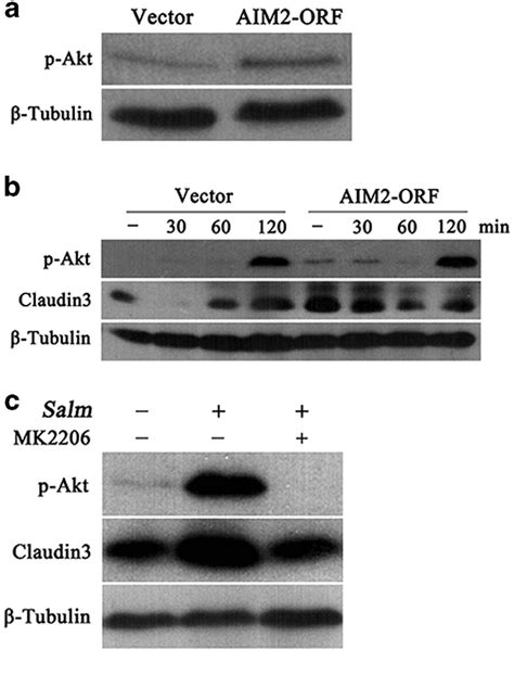 Absent In Melanoma Aim Induced Enhancement Of Tight Junction