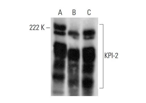 Anti KPI 2 Antibody D 11 SCBT Santa Cruz Biotechnology