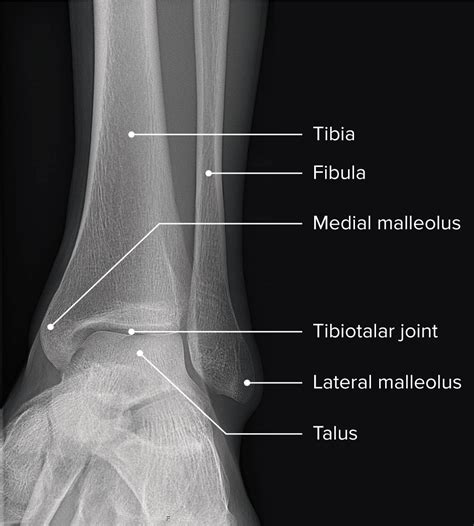 Anatomy Of The Ankle Bones Ankle Joint Anatomy Concise Medical The