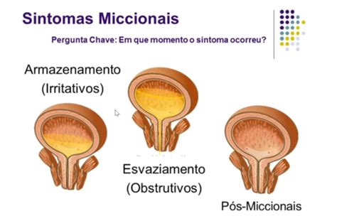 Disfunções miccionais Flashcards Quizlet