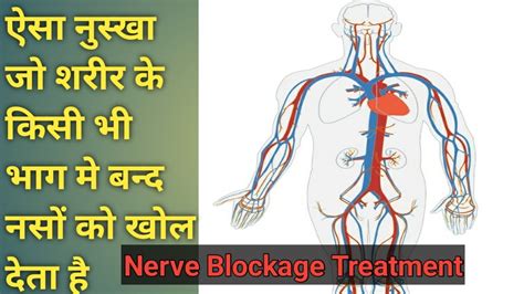 Band Naso Ko Kholne Ka Nuskha Saytika Sciatica Nerve Block