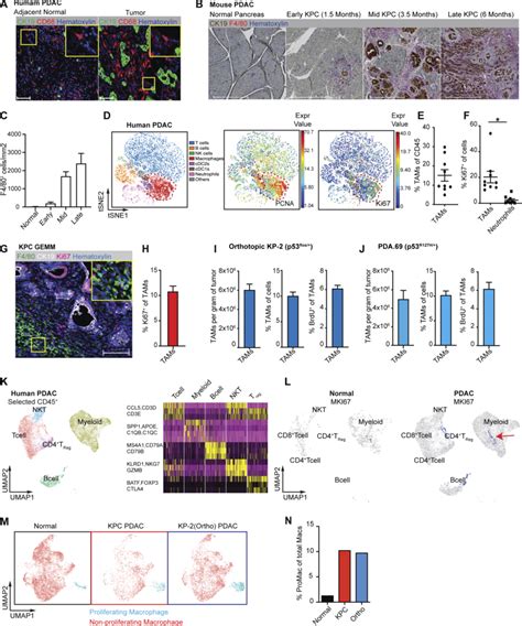 PDAC Infiltrating Macrophages Are Highly Proliferative A