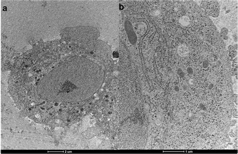 Transmission Electron Microscope Specimen