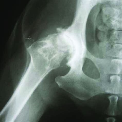 Radiograph of Ventro-dorsal extended view external rotation shows... | Download Scientific Diagram