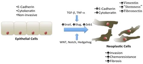 Schematic Of Epithelial To Mesenchymal Transition Emt Including