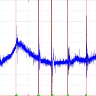 The myogram. The thin solid line demonstrates signals of myogram, the ...