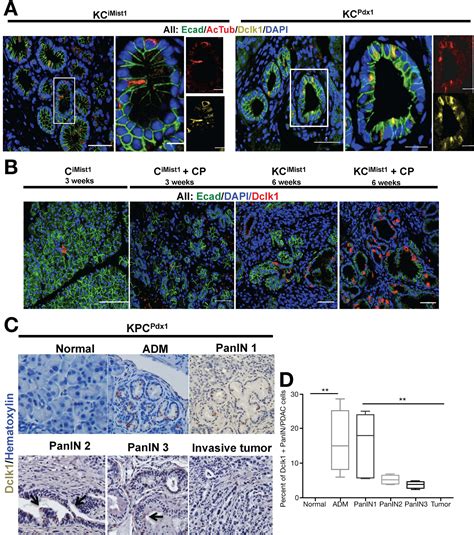 Dclk1 Marks A Morphologically Distinct Subpopulation Of Cells With Stem