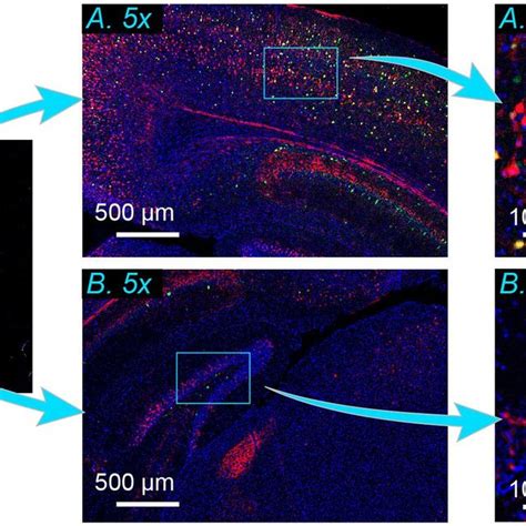 Imaging of mouse brain slice. Multi-color image of a mouse brain slice ...