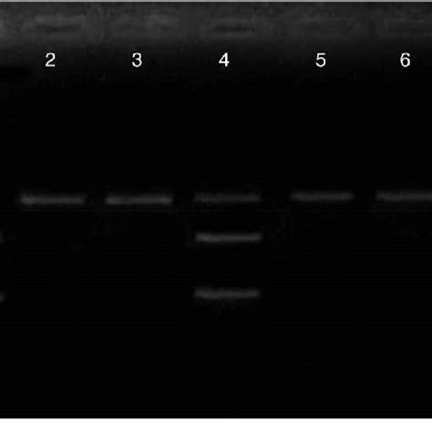 Agarose Gel Electrophoresis Of Pcr Rflp Of Lper Gene Gln223arg Snp