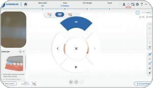 Aoralscan Elite Intraoral Photogrammetry Scanner Roe Dental Laboratory