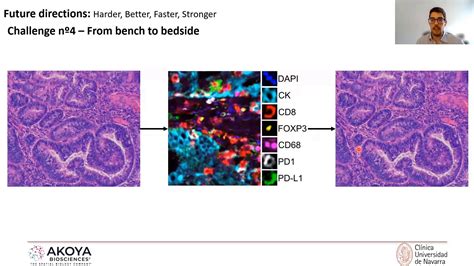 Beyond Cell Densities Spatially Resolved Methods To Analyze Tumor