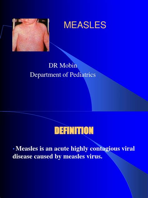 Measles Presentation Ppt Measles Infection