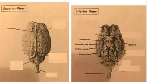 Sheep S Brain Superior And Inferior Diagram Quizlet