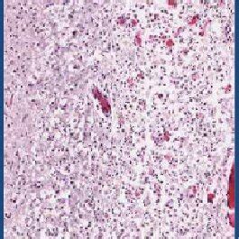 Scanned H&E-stained section of hippocampus obtained at autopsy from a ... 