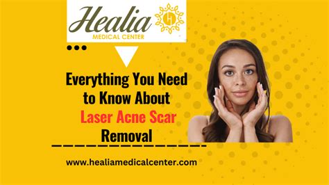 Laser Acne Scar Removal Treatment Dr Helia Naseri