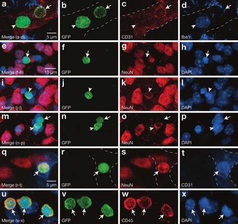 Phenotype Of Donor Derived Cells With A Round Morphology A D Confocal