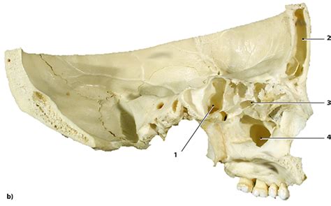 Paranasal Sinuses Lateral View Diagram Quizlet