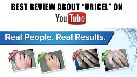 Uricel Review - Does This Product Really Work? DON'T BUY URICEL UNTIL ...