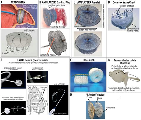 Left Atrial Appendage Closure For Stroke Prevention In Non Valvular