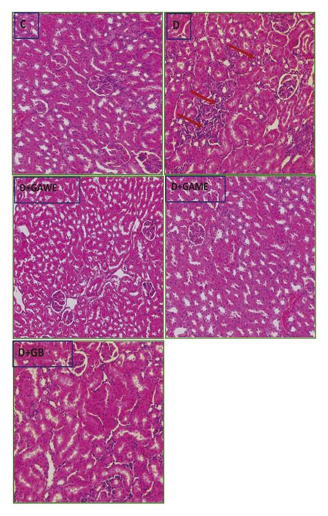 C Normal Rat Kidney D Diabetes Provoked Inflammation In Kidney