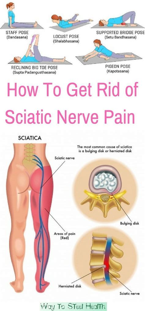 Physical Therapy Exercises For Sciatica Nerve - Peace Of Mind Home ...